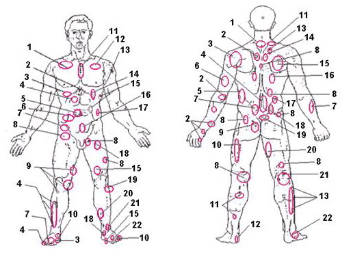 Projection zones of organs • Spinor-M